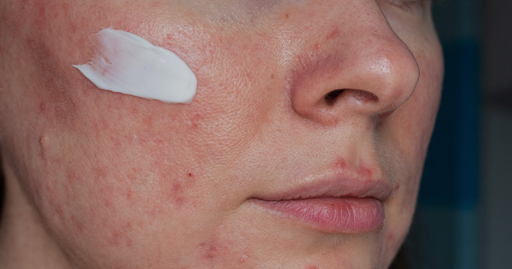 Herstel van je huid na de feestdagen: een routine om te kalmeren, verzachten en in balans te brengen