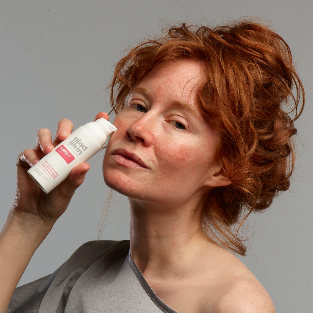 Een vrouw met rosacea in het gezicht heeft een gladskin rosacear product in haar hand