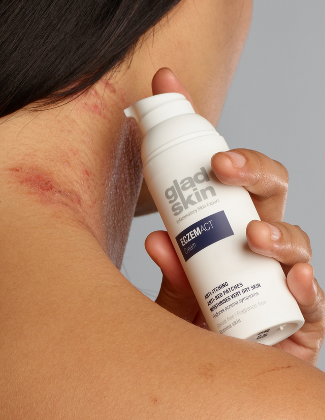 ECZEMACT Cream is een medisch hulpmiddel dat Staphefekt bevat en de eczeemsymptomen in enkele dagen vermindert.