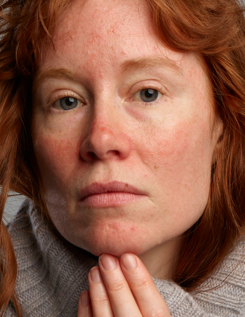 Vermindert puistjes en roodheid in het gezicht inclusief makeup remover